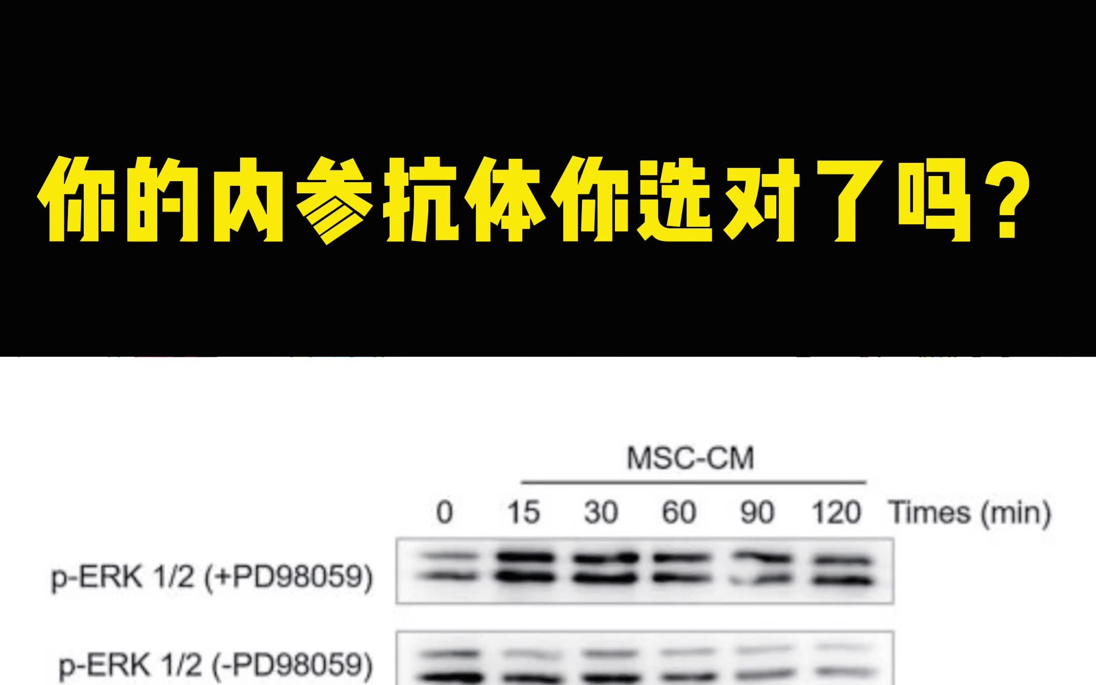 WB实验中,你的内参抗体选对了吗?一起来聊聊吧!哔哩哔哩bilibili