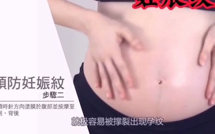 哪几类孕妇容易长妊娠纹?这几点要注意哔哩哔哩bilibili