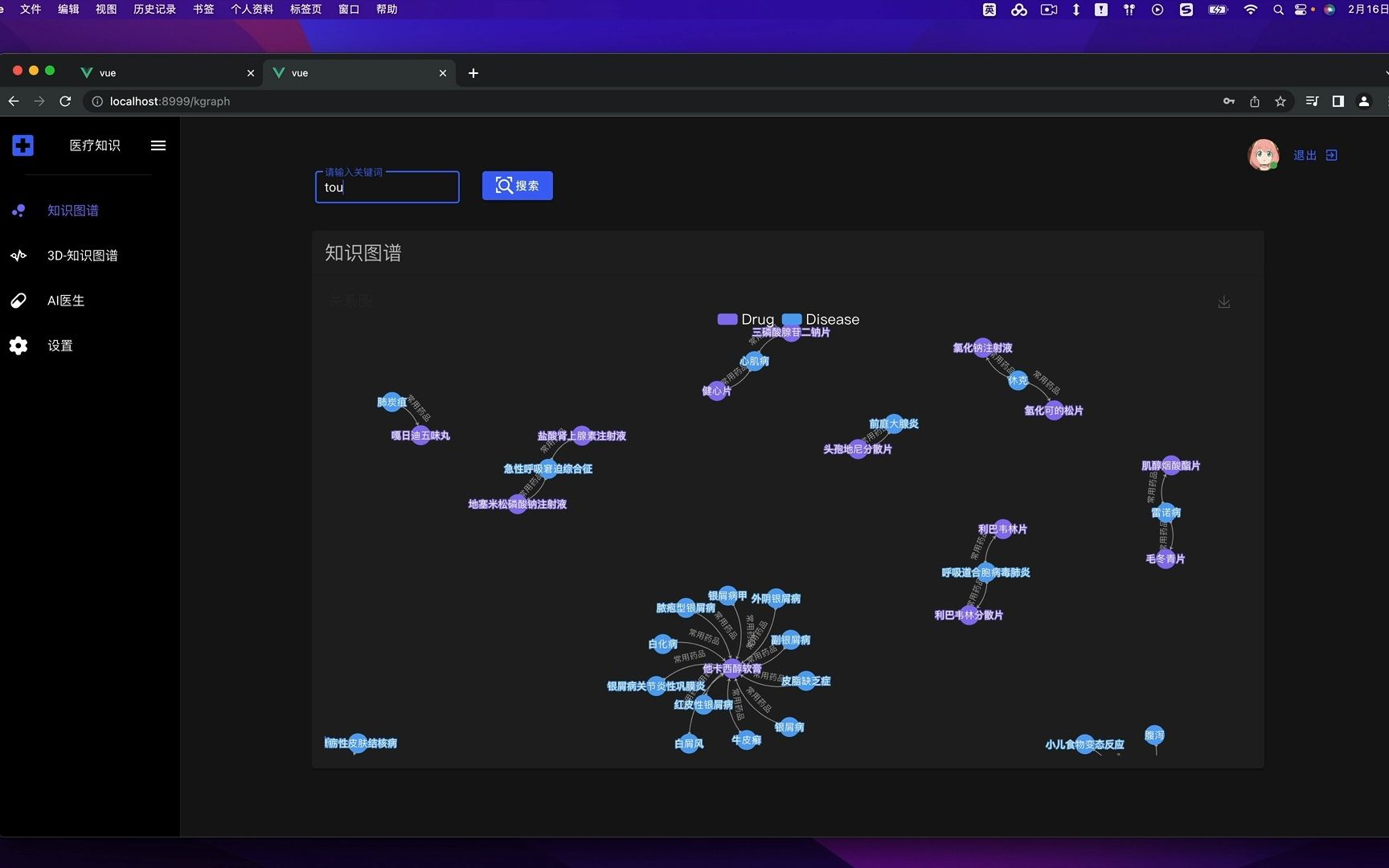 Vue+Django 医疗疾病知识图谱问答neo4j KGQA系统哔哩哔哩bilibili