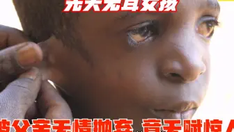 非洲纪录片：无耳怪胎女孩真可怜！被父亲抛弃，谁知她竟天赋惊人