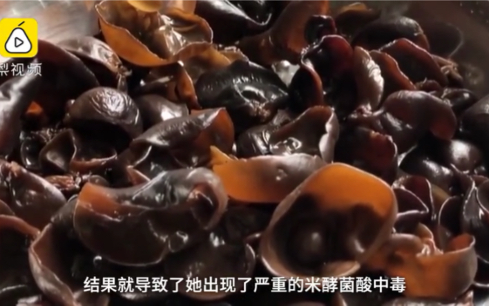 女子吃完泡发木耳后不幸身亡生前长期浸泡导致米酵酸菌中毒