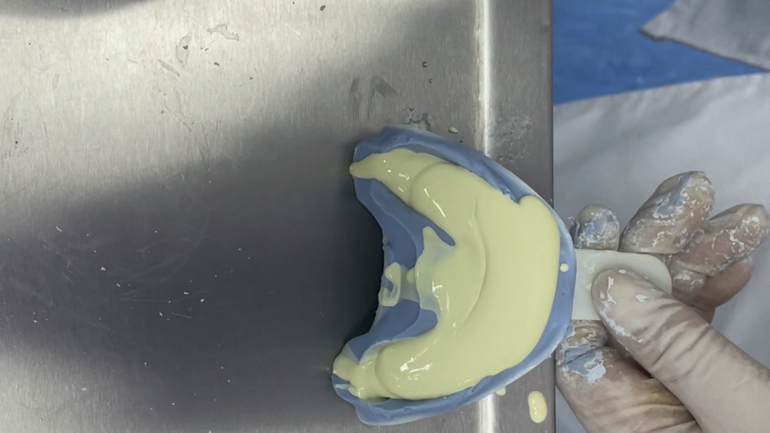 喜牙力定做保持器取牙模石膏教程