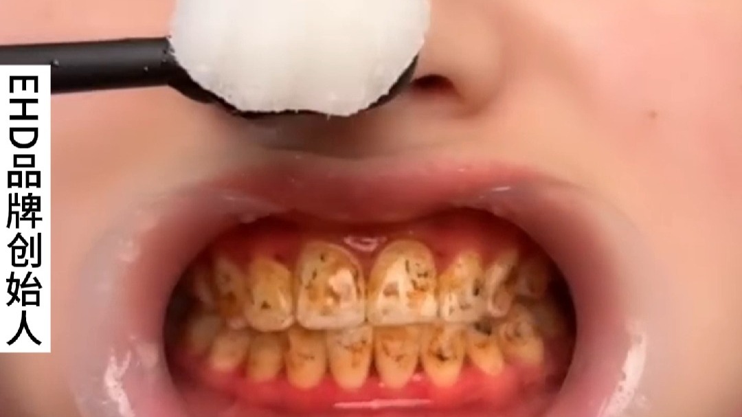 厚厚的黄牙渍刷不掉?是你的方法没用对