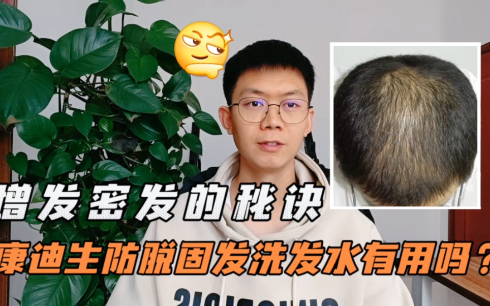 康迪生防脱固发洗发水有用吗,推荐真正可以防脱生发的宝贝.