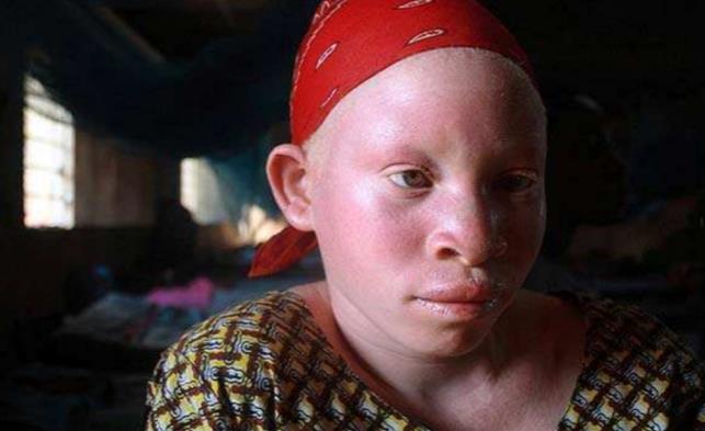 全球最"贵"的一类病人,价值126万,常被富人买去祈福