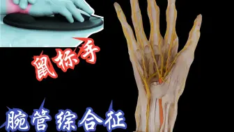 “鼠标手”的腕管