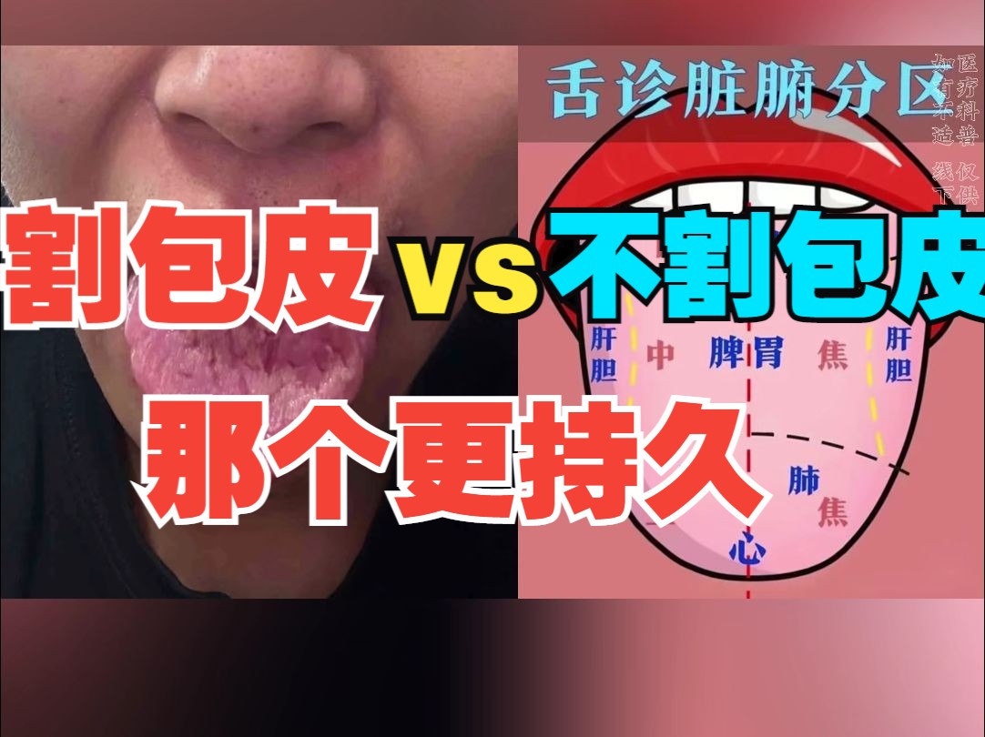 割包皮挂号哪个科(割包皮应该挂什么号)