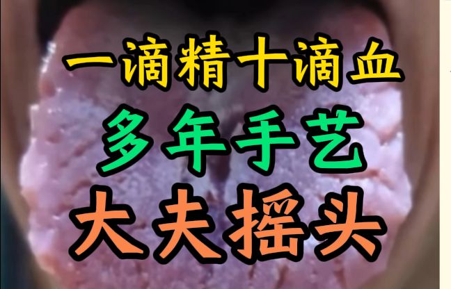 舌诊分析:一旦出现这种舌头,必须管住手,否则神医来了也没用!哔哩哔哩bilibili