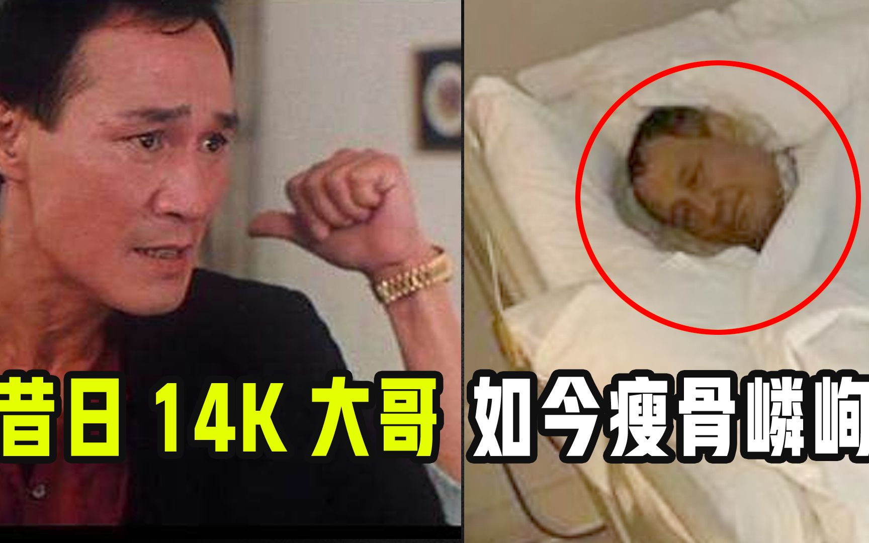 77岁陈惠敏患癌!如今枯瘦如柴!曾演古惑仔,一拳KO日本冠军!哔哩哔哩bilibili