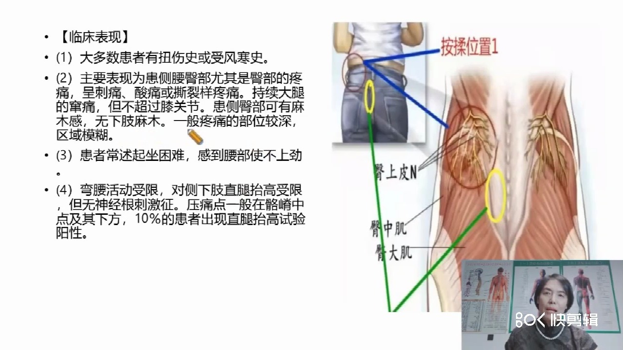 臀上皮神经炎压痛点图图片