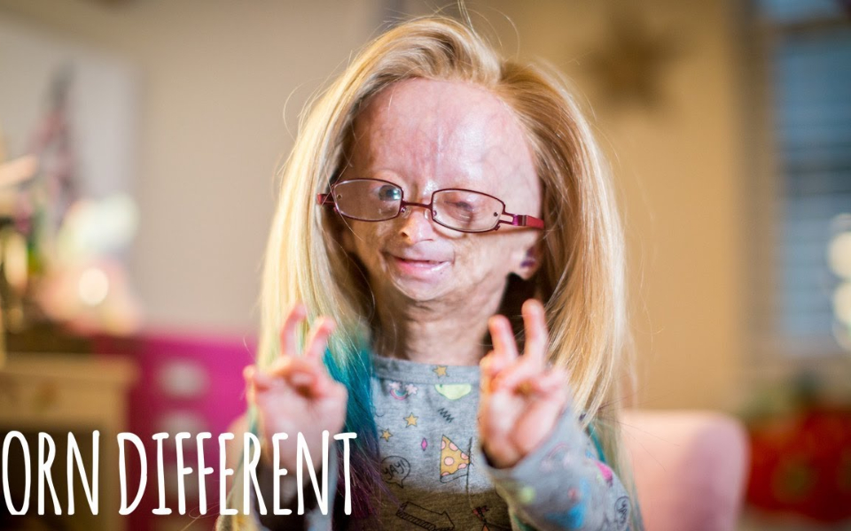 早衰成80岁老人但其实她是一个11岁的小萝莉油兔不二字幕组