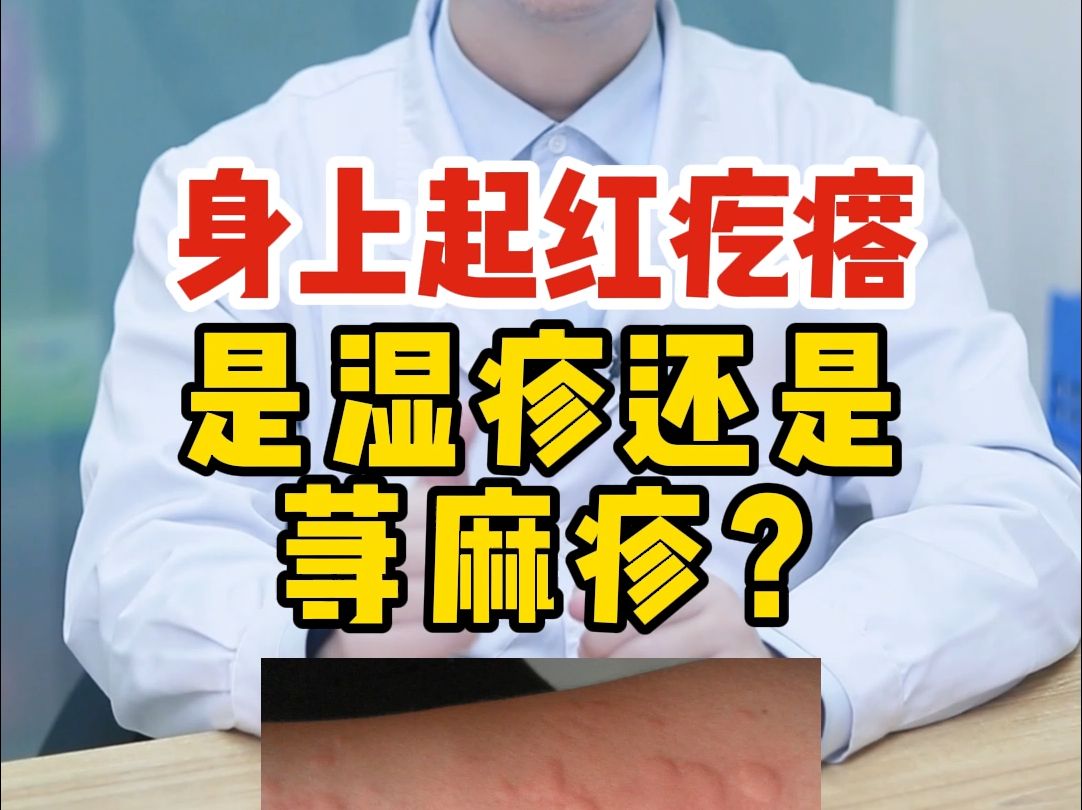 身上起了红疙瘩,是湿疹还是荨麻疹?哔哩哔哩bilibili