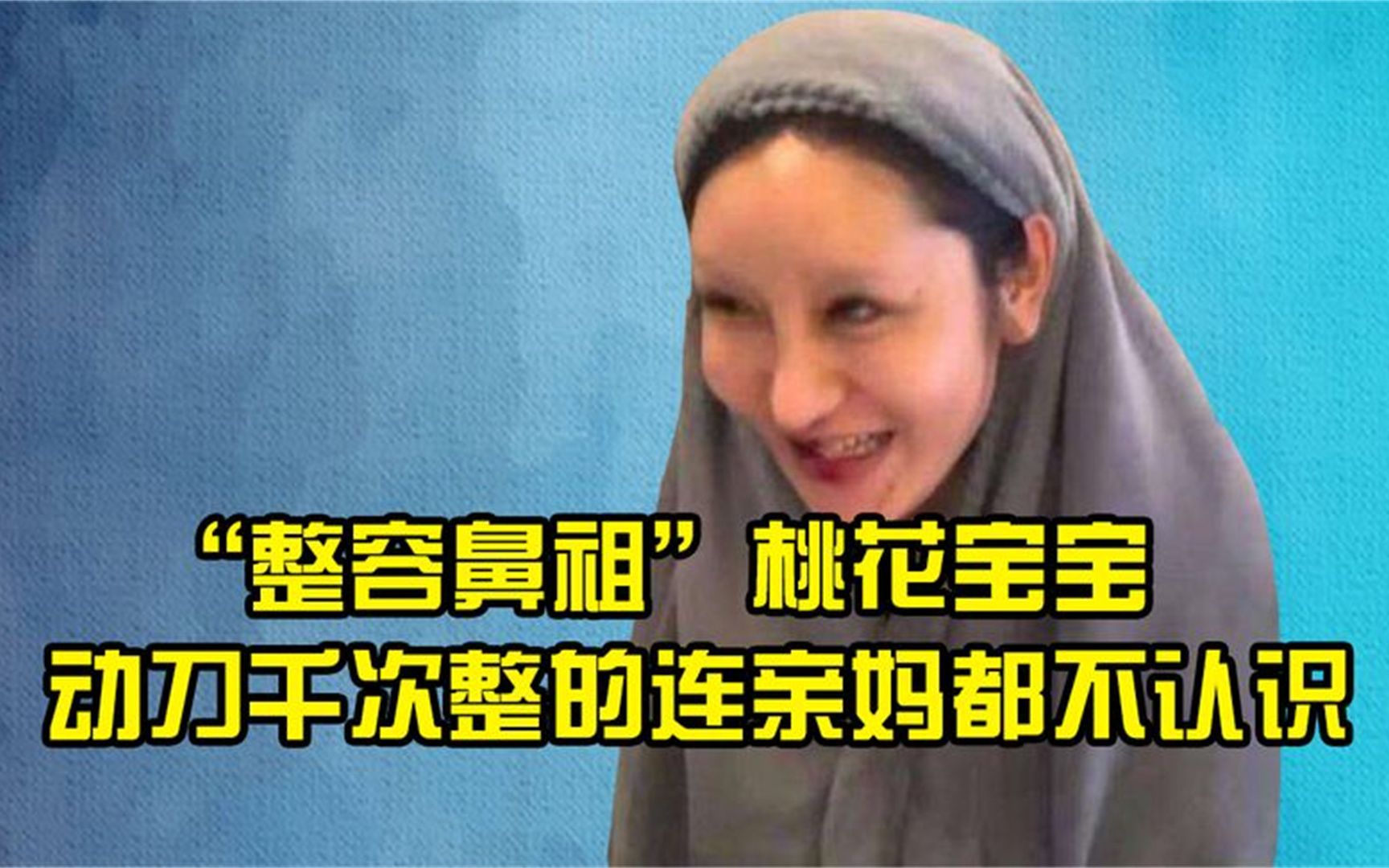 "整容鼻祖"桃花宝宝,8年在脸上动刀千次,整的连亲妈都不认识