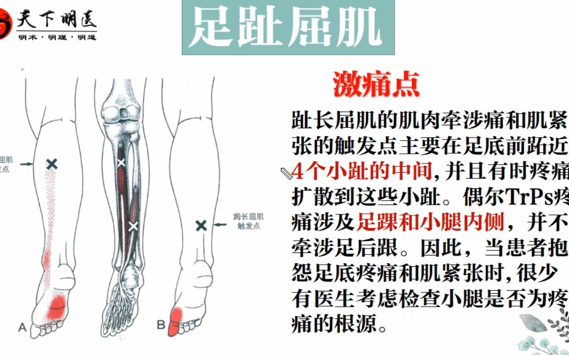 《足趾长屈肌》——'爪型趾'的重要原因哔哩哔哩bilibili