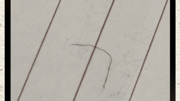 我在亲亲虾条里吃出一根毛