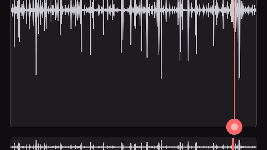 20191209肠鸣音右下腹部鼓音(肚子咕噜咕噜的声音)哔哩哔哩bilibili