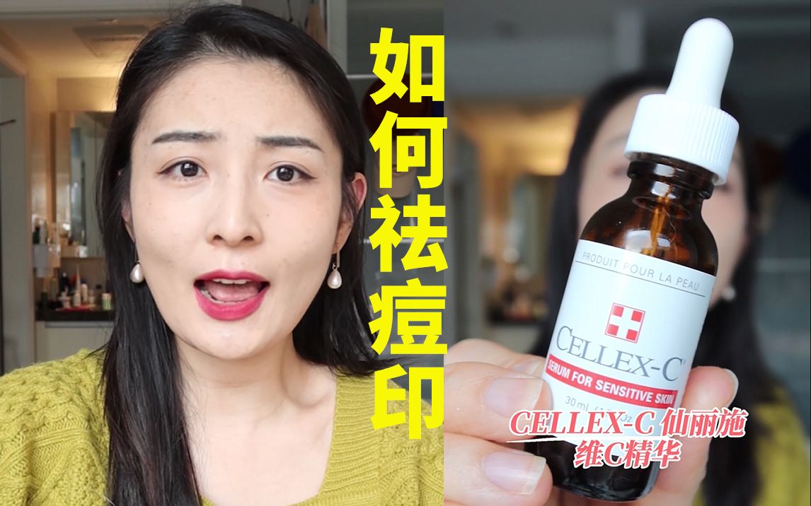 【雪姨田小雪】作为大干皮闭口痘痘层出不穷!但是我痘印反而不多!