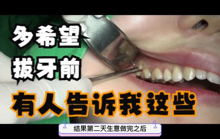 [图]拔智齿前，这些准备工作要做好