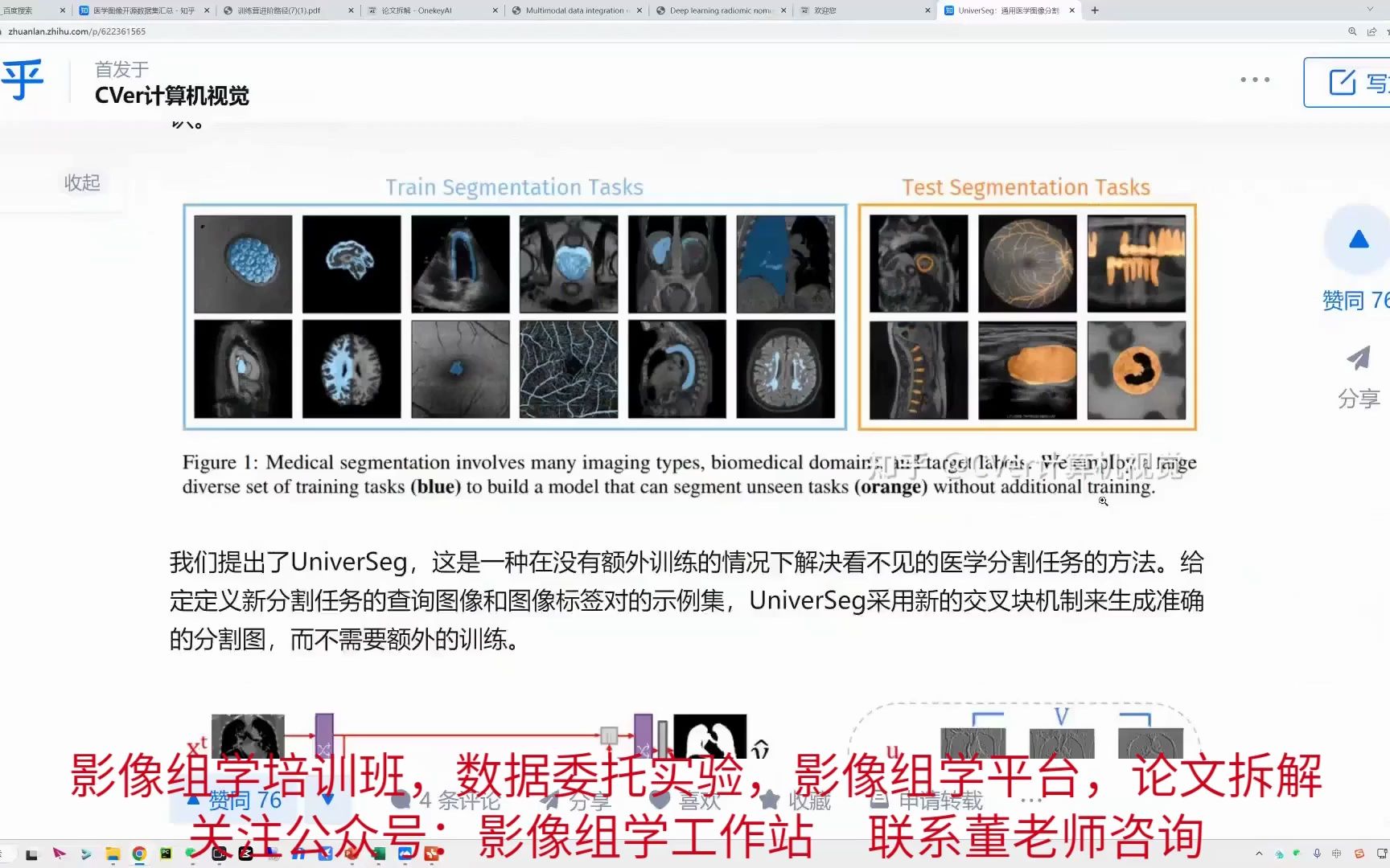 基于影像组学技术的脊柱脊髓病变定量评估研究的论文思路哔哩哔哩bilibili