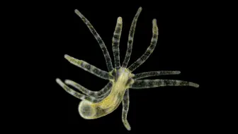 【水螅】传说中的“九头蛇”  可以自我克隆的淡水小怪兽 @柚子木字幕组