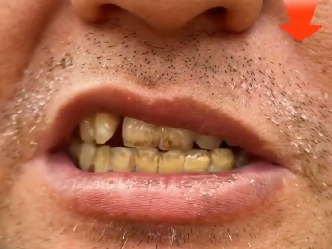 牙黄嘴巴难闻的你,别再用普通牙膏了!