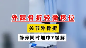 Download Video: 外踝骨折轻微移位 关节外骨折 静养同时加中Y缓解