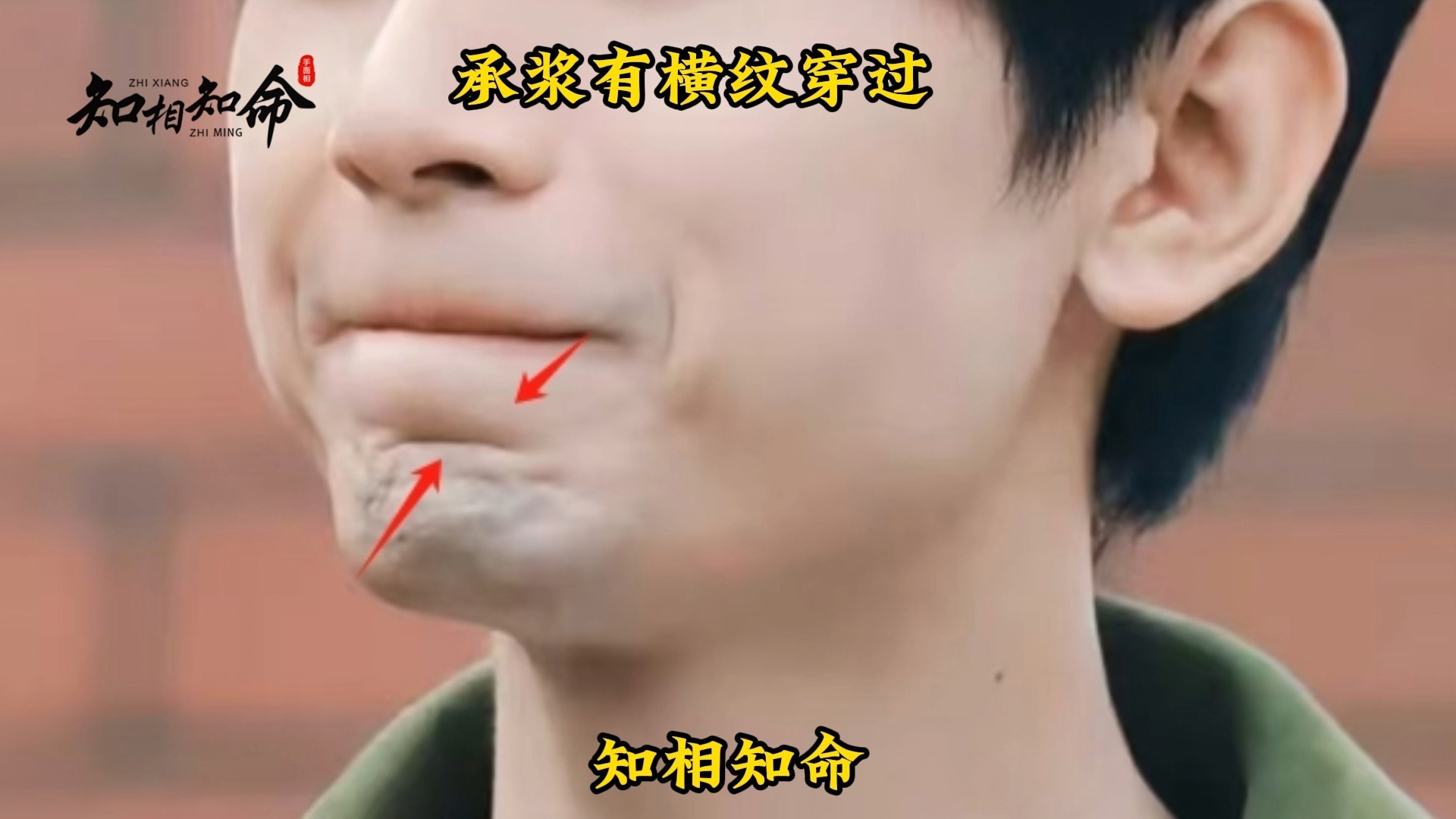 识人有术,承浆有横纹穿过