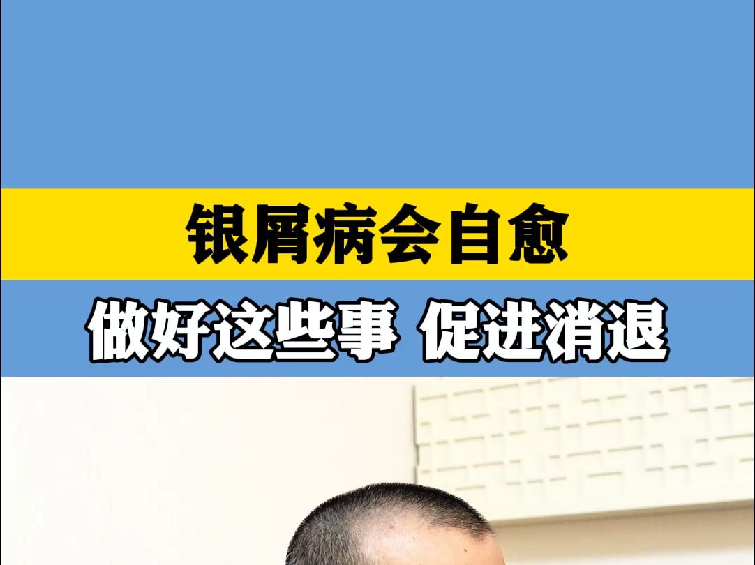 皮肤科娄卫海:银屑病会自愈 做好这些事 促进消退哔哩哔哩bilibili