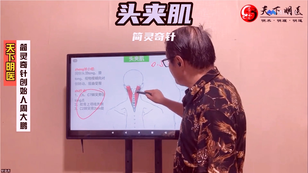 头夹肌——头顶痛要找它!4个方面全方位讲解——天下明医平台简灵奇针