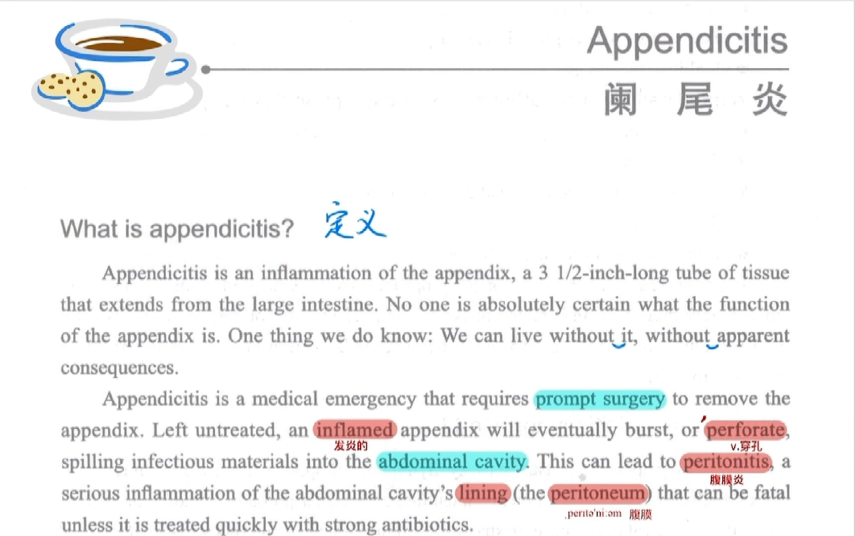 [图]阑尾炎｜医学英语文章朗读，好好听哦！