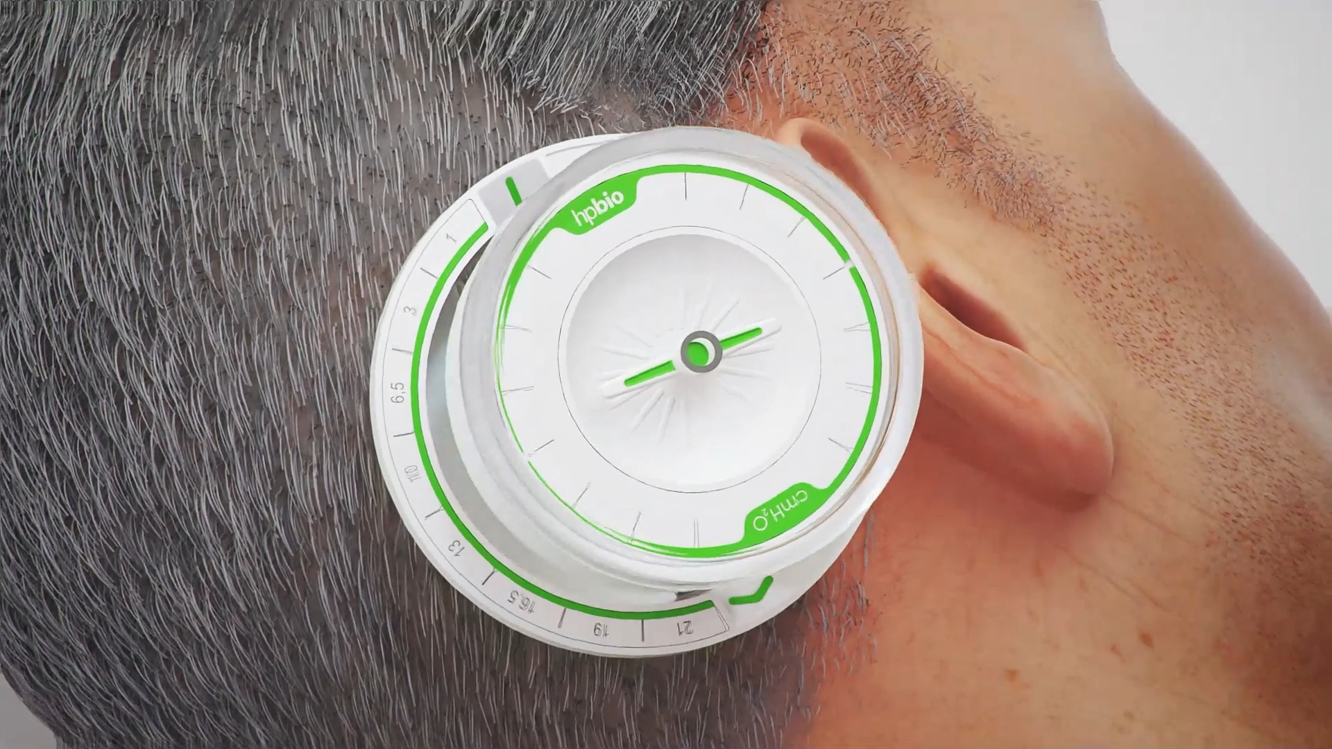 hpbio-spherapro-and-regpro可调压脑积水分流器及附件介绍视频