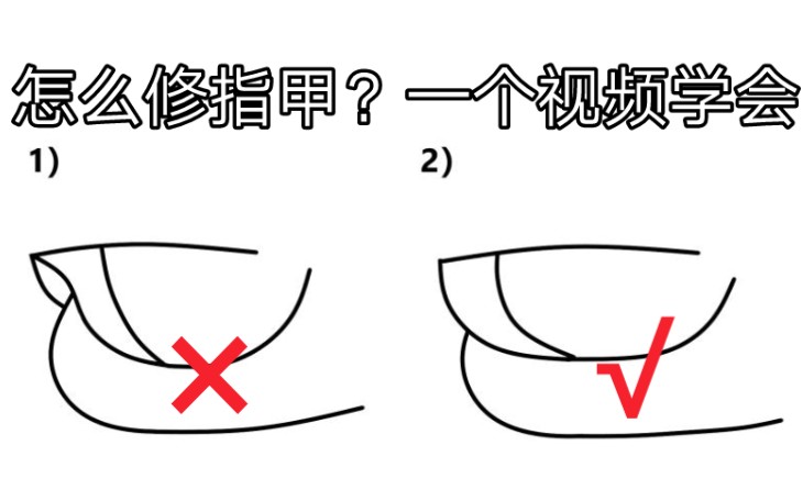 [图]【吉他】拨弦手指甲修整完全教程