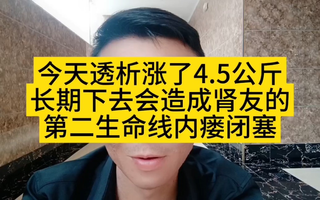 [图]尿毒症透析每次透4.5公斤水，时间久了会缩短自己的寿命