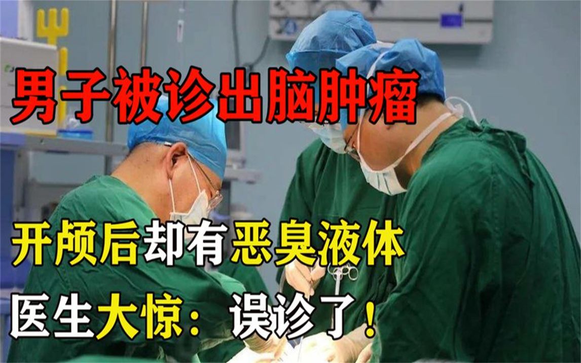 [图]男子被诊出脑肿瘤，开颅后却有恶臭液体喷出，医生大惊：误诊了！