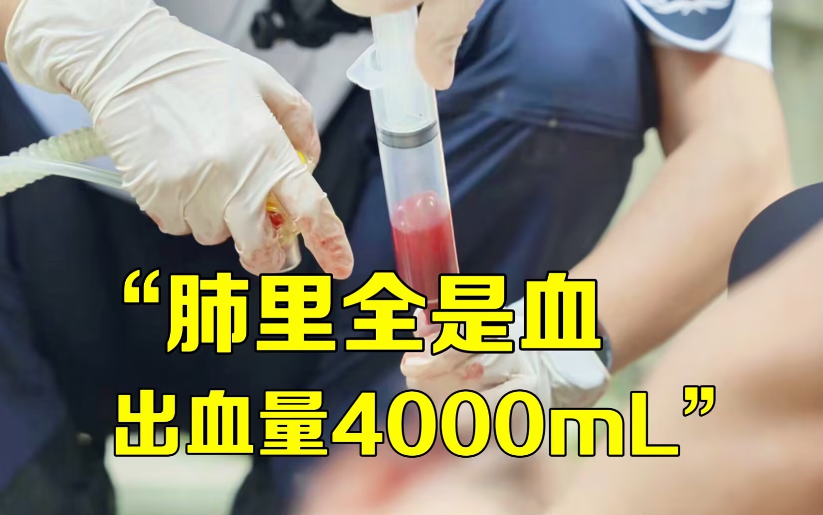 男子从13楼坠落，医生抢救后直言：“活不了”