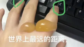 女生吃梅花糕手指被烫出大水泡，无奈两次跑医院，提醒：吃梅花糕一定要小心烫伤