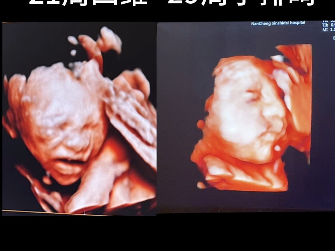 胎儿头尖的图片图片