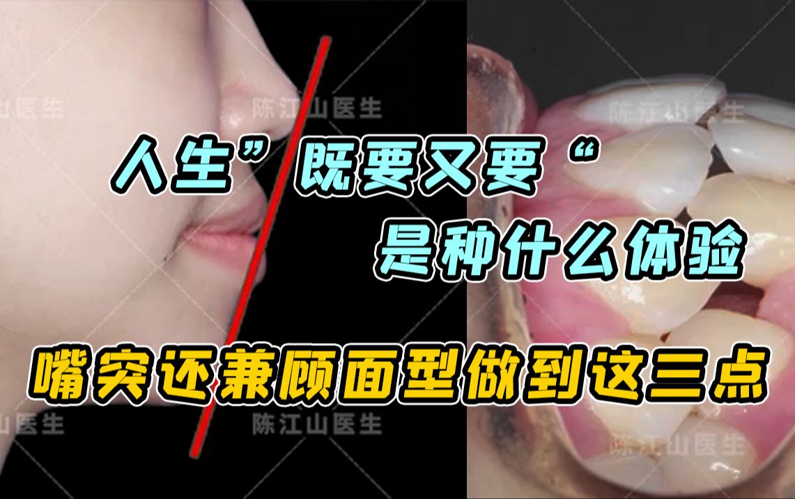 【高角嘴凸+地包天女生】既要又要!矫正能同时满足吗?哔哩哔哩bilibili