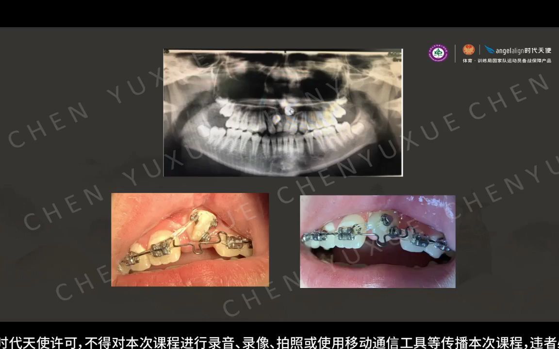 浙大口腔多校联动隐形正畸论坛10.17早矫专场哔哩哔哩bilibili