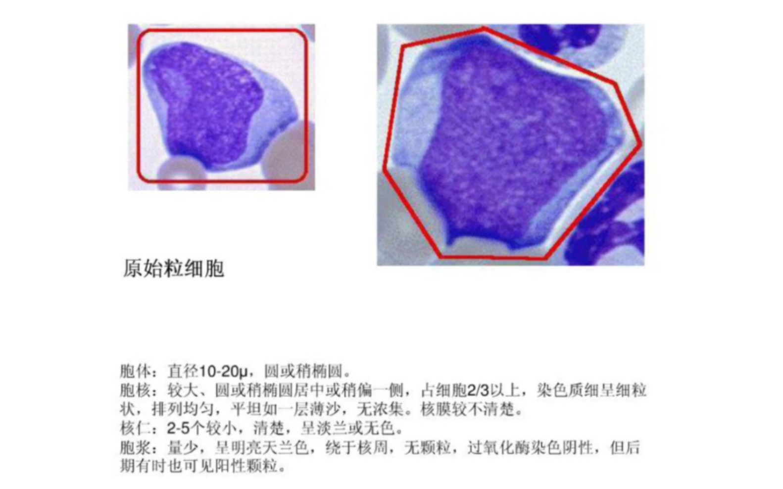 [图]临床血液学检验粒系原始细胞图谱