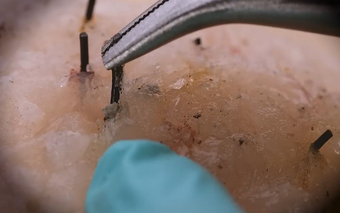 【asmr】显微镜下我的黑头有这么粗这么硬 |声控福利