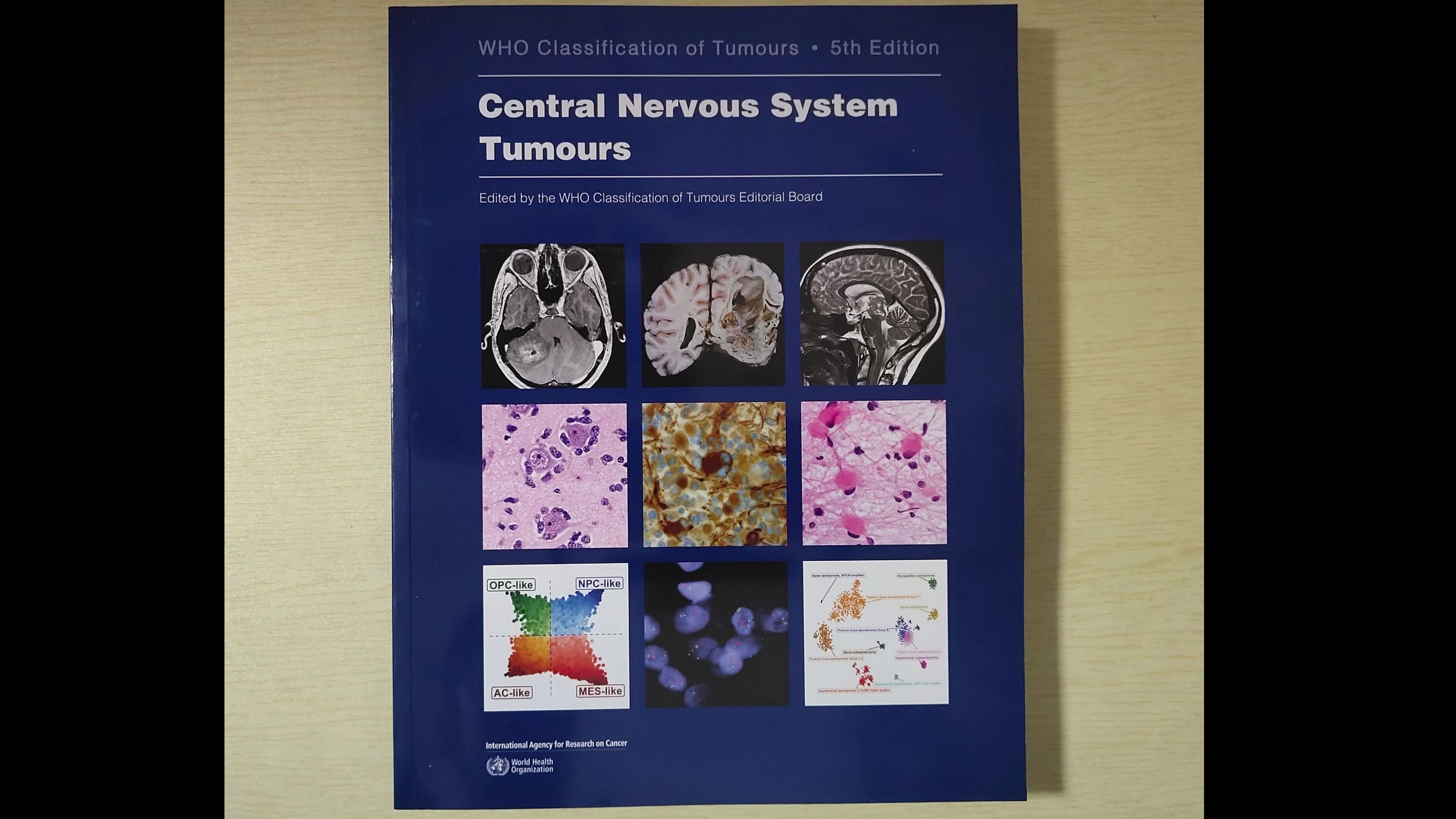 《中枢神经系统肿瘤:世界卫生组织人体肿瘤分类第五版》哔哩哔哩bilibili