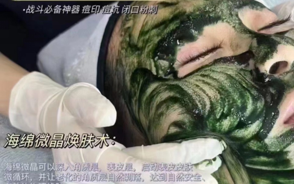 海绵微针焕肤 #痘坑痘印毛孔粗大 #暗黄暗沉皮肤怎么办来领招 #居家