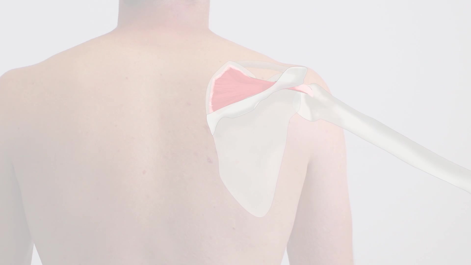 [图]Examination of the Rotator Cuff - Jobe Test - Clinical Examination