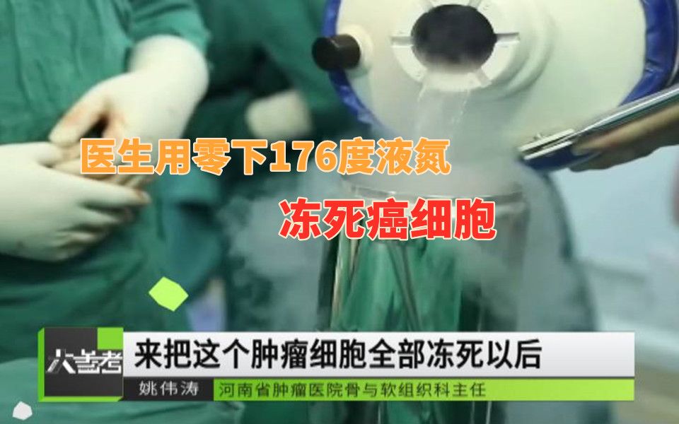 【喜财弟弟】牛!医生用零下176度液氮冻死癌细胞救8岁男孩哔哩哔哩bilibili