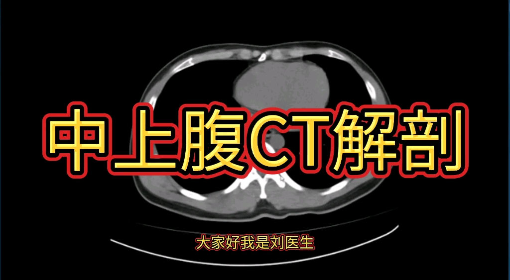 中上腹部CT解剖分享,简单易懂,初学者必备!哔哩哔哩bilibili