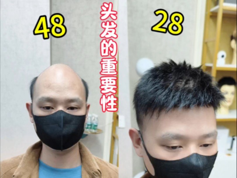 硅胶假发硅胶植发(硅胶娃娃假发和植发)