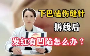 Download Video: 小朋友下巴磕伤缝针，拆线后疤痕发红有凹陷这么办？