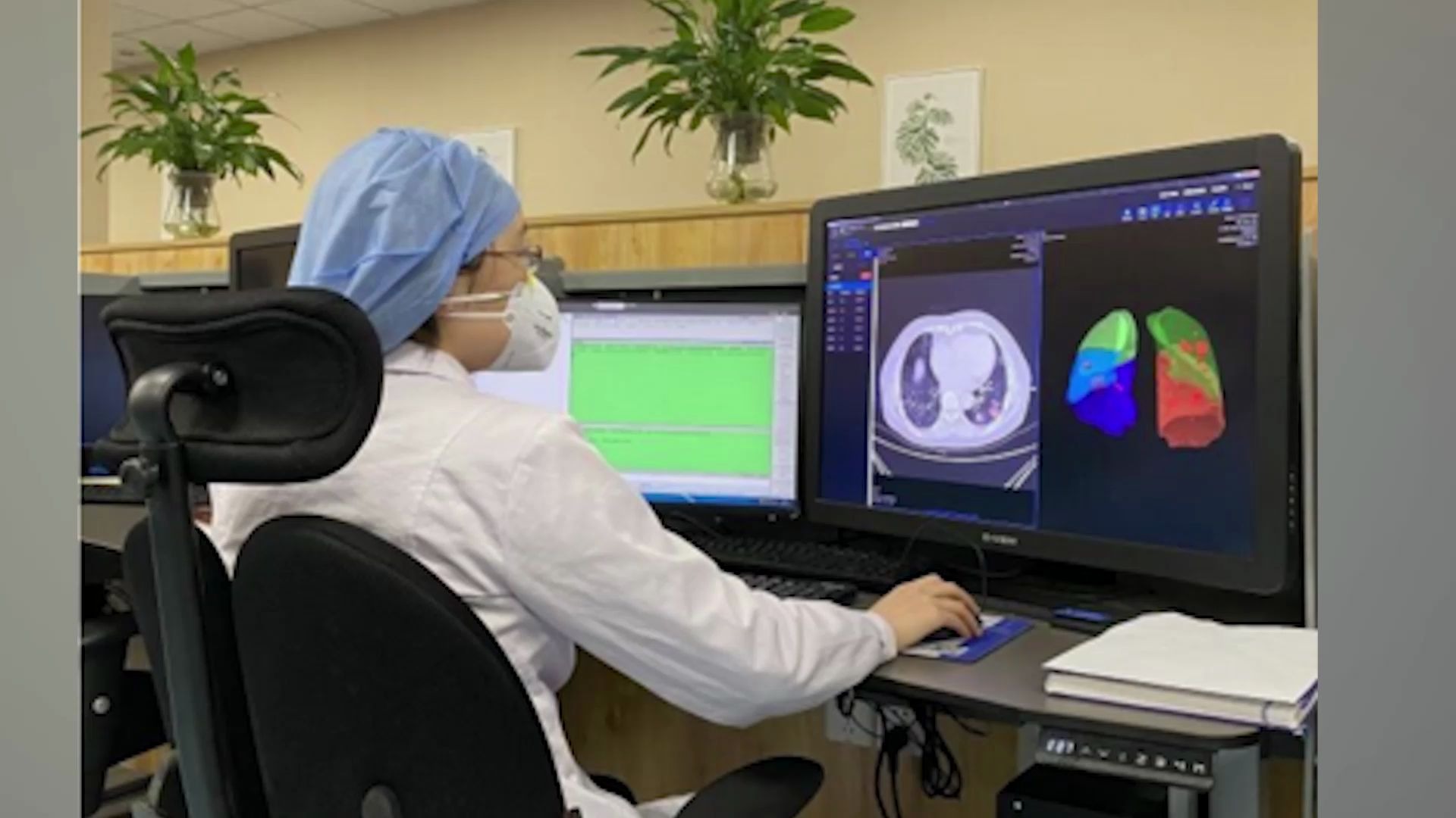 20秒识别是否患新冠肺炎,中国造出ai辅助诊断系统成"国外及时雨"_哔哩