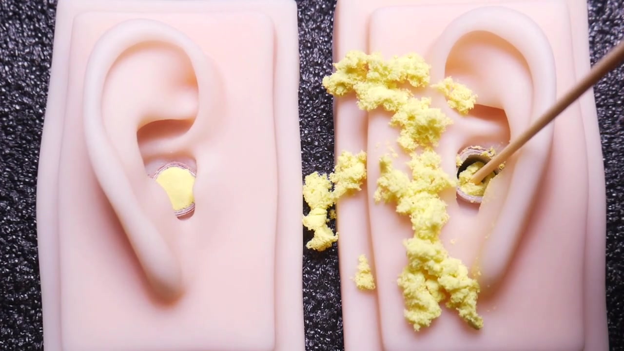 [blije]砂耳垢清理,掏得酥酥麻麻